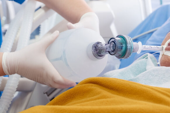 Doctor holding oxygen ambu bag over patient given oxygen to patient by intubation tube
